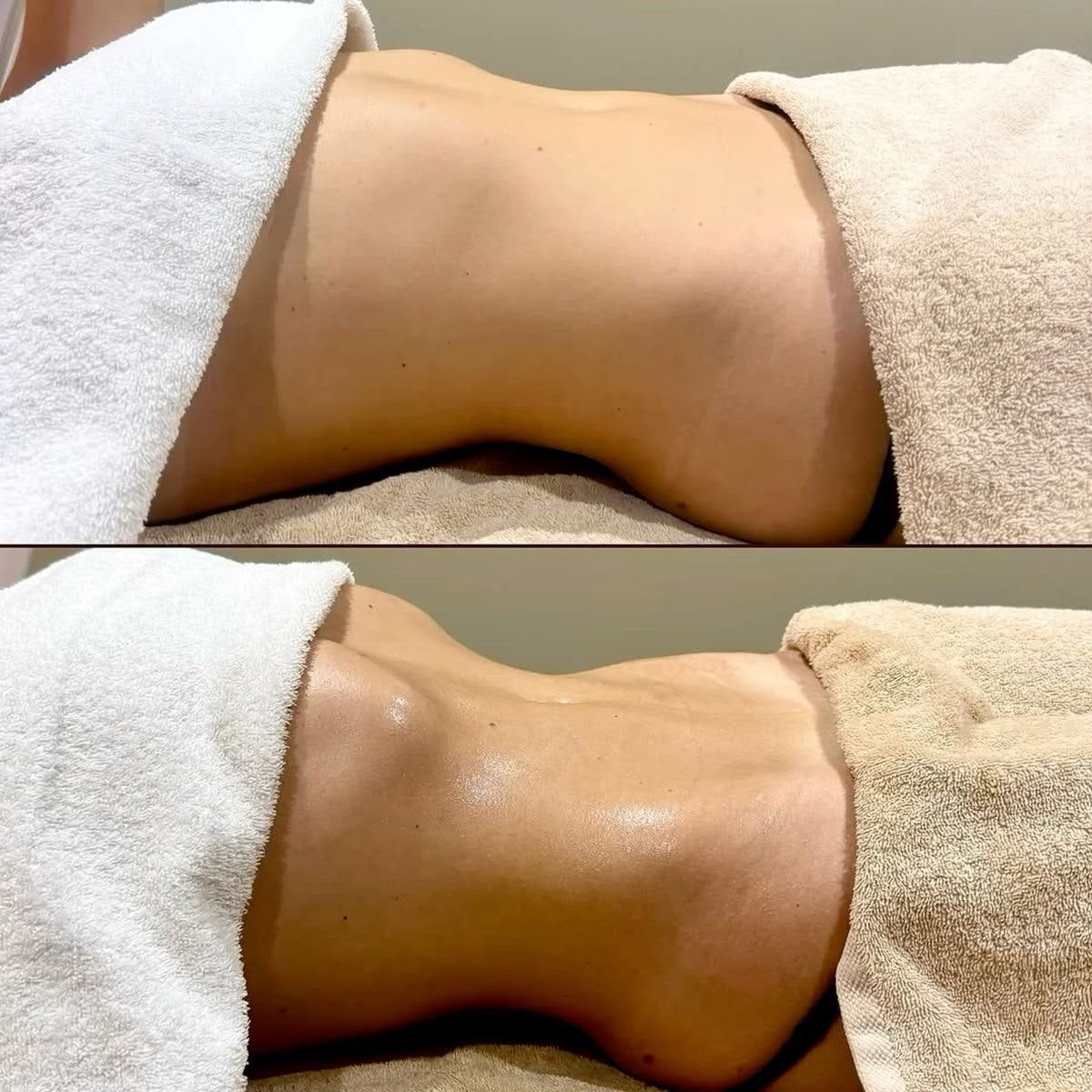 Liposcultura, trattamento estetico non invasivo al Giorgia P Beauty Lab, Roma zona EUR