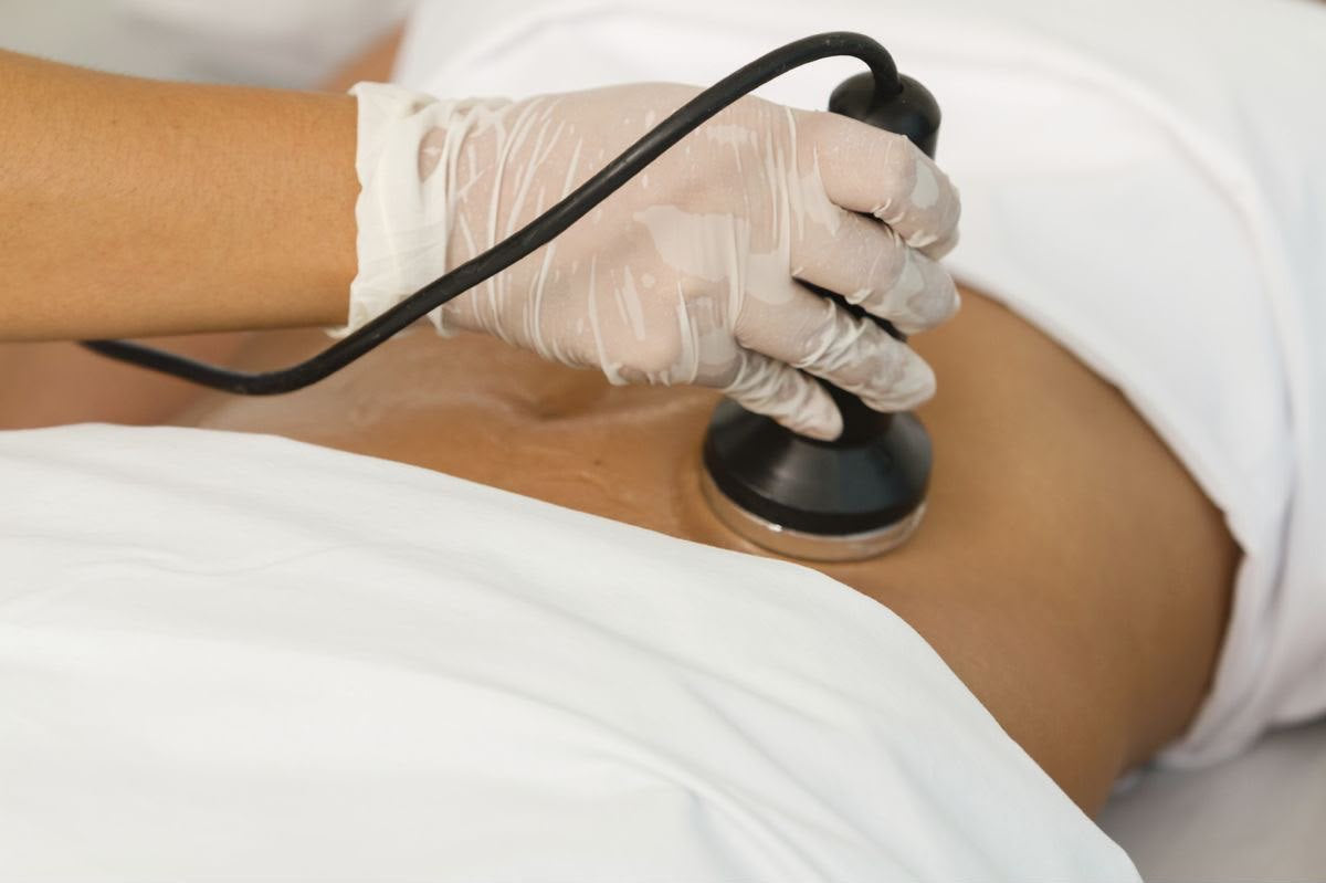 Biolifting Corpo, trattamento estetico non invasivo al Giorgia P Beauty Lab, Roma zona EUR