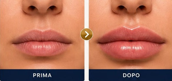 BB Lips, trattamento estetico non invasivo al Giorgia P Beauty Lab, Roma zona EUR