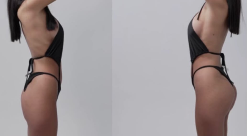 Gluteo Up Lift, trattamento estetico non invasivo al Giorgia P Beauty Lab, Roma zona EUR