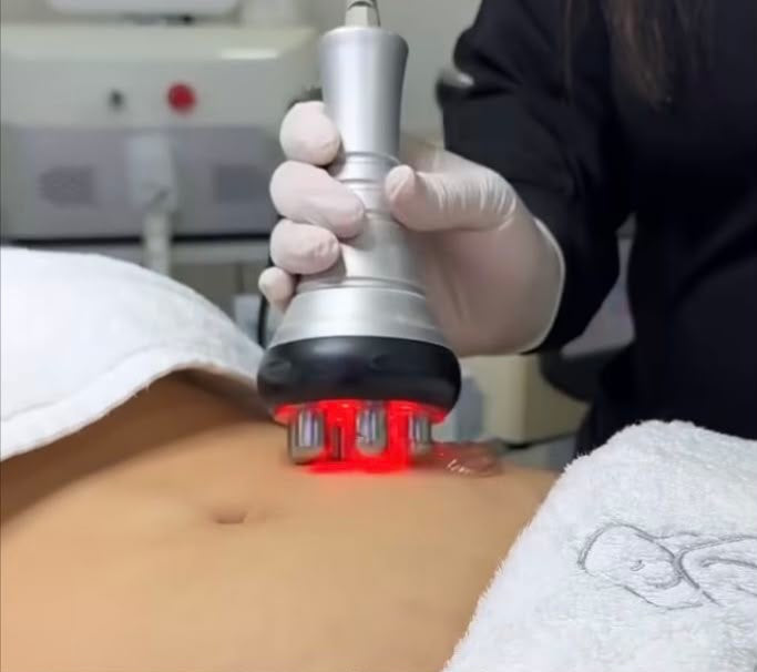 Laser Lipo, trattamento estetico non invasivo al Giorgia P Beauty Lab, Roma zona EUR
