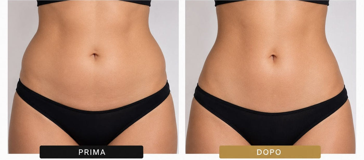Lipolite, trattamento estetico non invasivo al Giorgia P Beauty Lab, Roma zona EUR