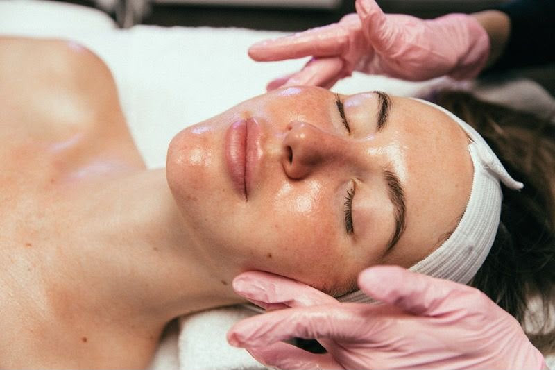 Peeling Niacinamide, trattamento estetico non invasivo al Giorgia P Beauty Lab, Roma zona EUR