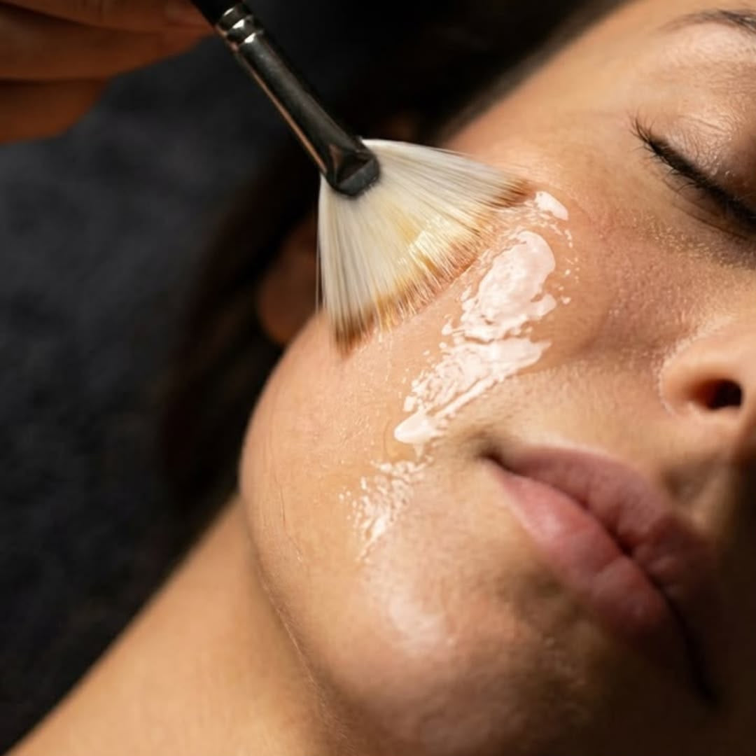 Peeling, trattamento estetico non invasivo al Giorgia P Beauty Lab, Roma zona EUR