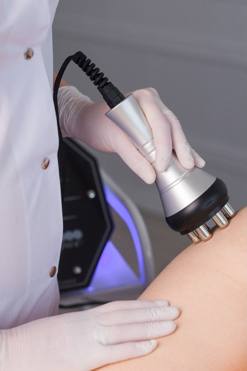Radiofrequenza Corpo, trattamento estetico non invasivo al Giorgia P Beauty Lab, Roma zona EUR
