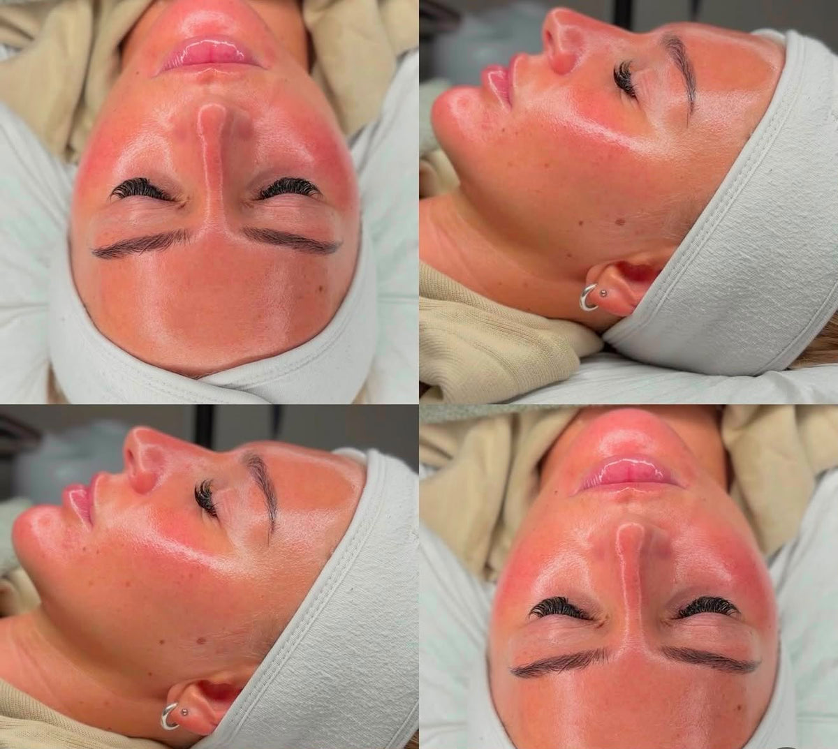 Skin Glass Coreano, trattamento estetico non invasivo al Giorgia P Beauty Lab, Roma zona EUR